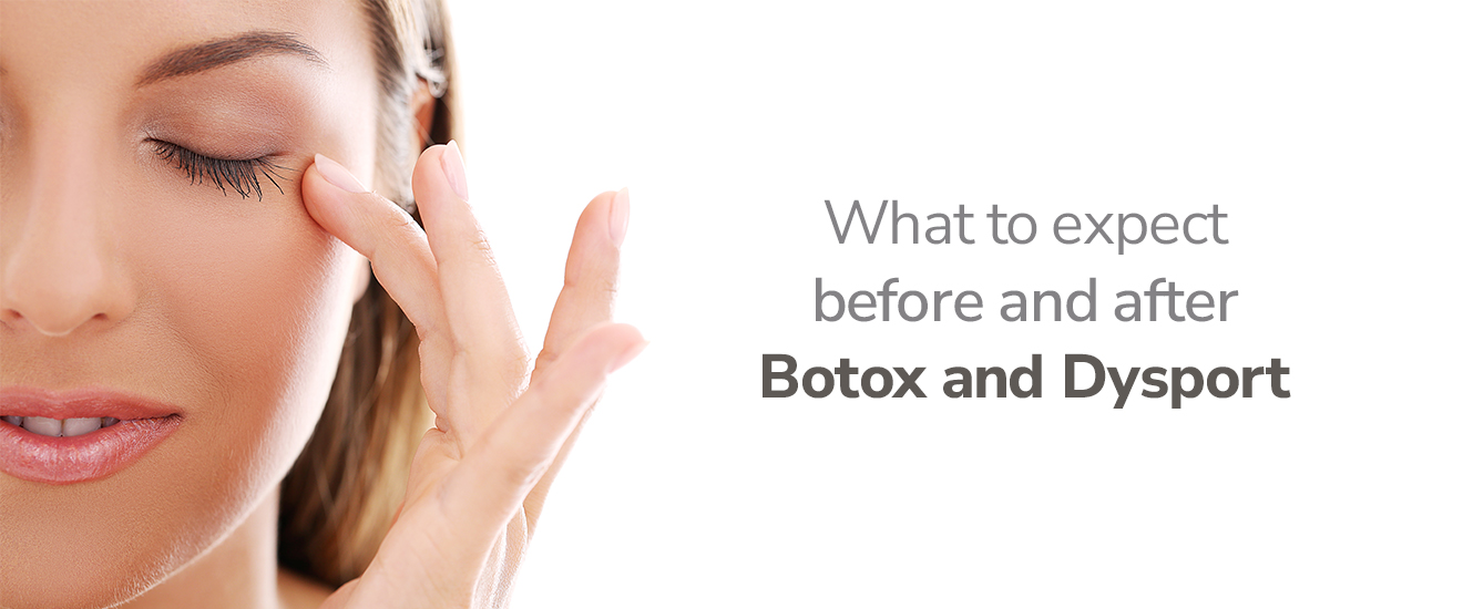 WHAT TO EXPECT BEFORE AND AFTER BOTOX AND DYSPORT