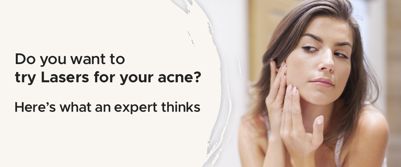 DO YOU WANT TO TRY LASERS FOR YOUR ACNE? HERE’S WHAT AN EXPERT THINKS