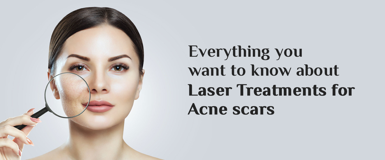 EVERYTHING YOU WANT TO KNOW ABOUT LASER TREATMENTS FOR ACNE SCARS IN LUXE MD AESTHETICS