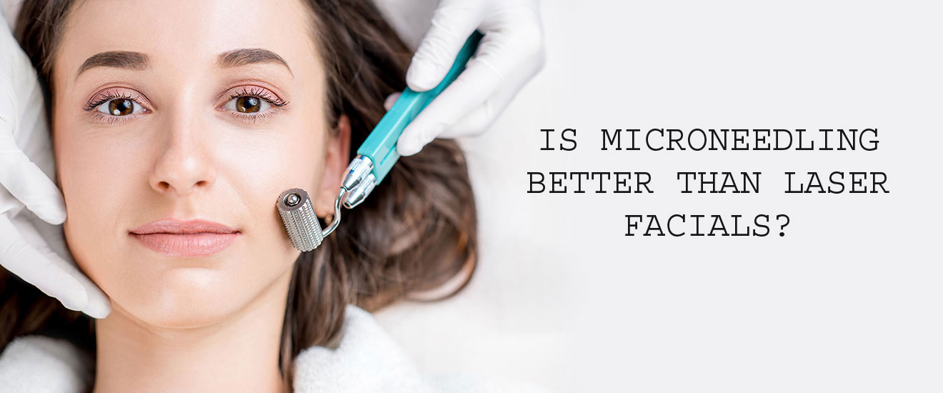 IS MICRONEEDLING BETTER THAN LASER FACIALS?