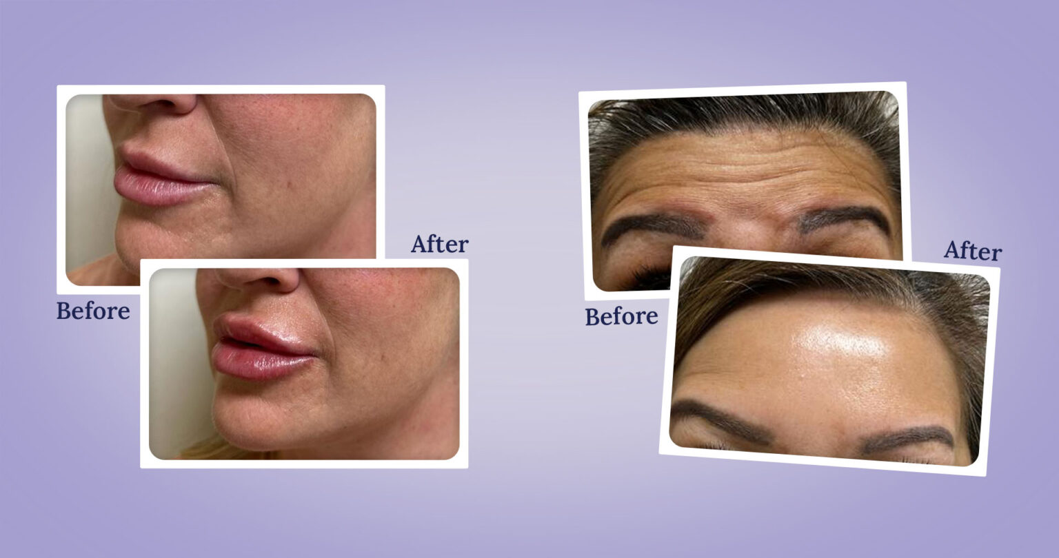 Best Medspa Las Vegas Medical Spa Las Vegas NV Aesthetic Laser Clinic