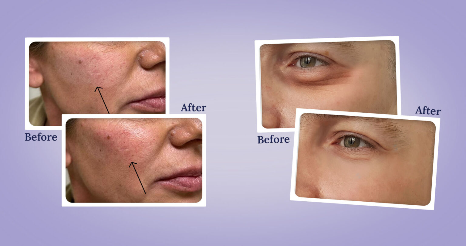 Best Medspa Las Vegas Medical Spa Las Vegas NV Aesthetic Laser Clinic