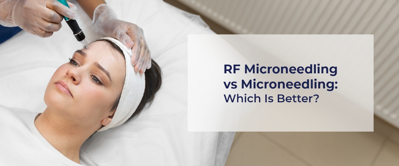 RF Microneedling vs Microneedling: Which Is Better?